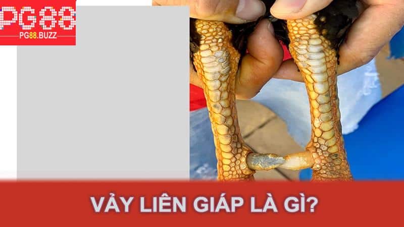 Vảy liên giáp là gì?